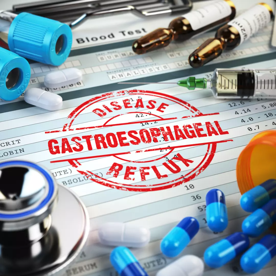 Reflusso gastroesofageo